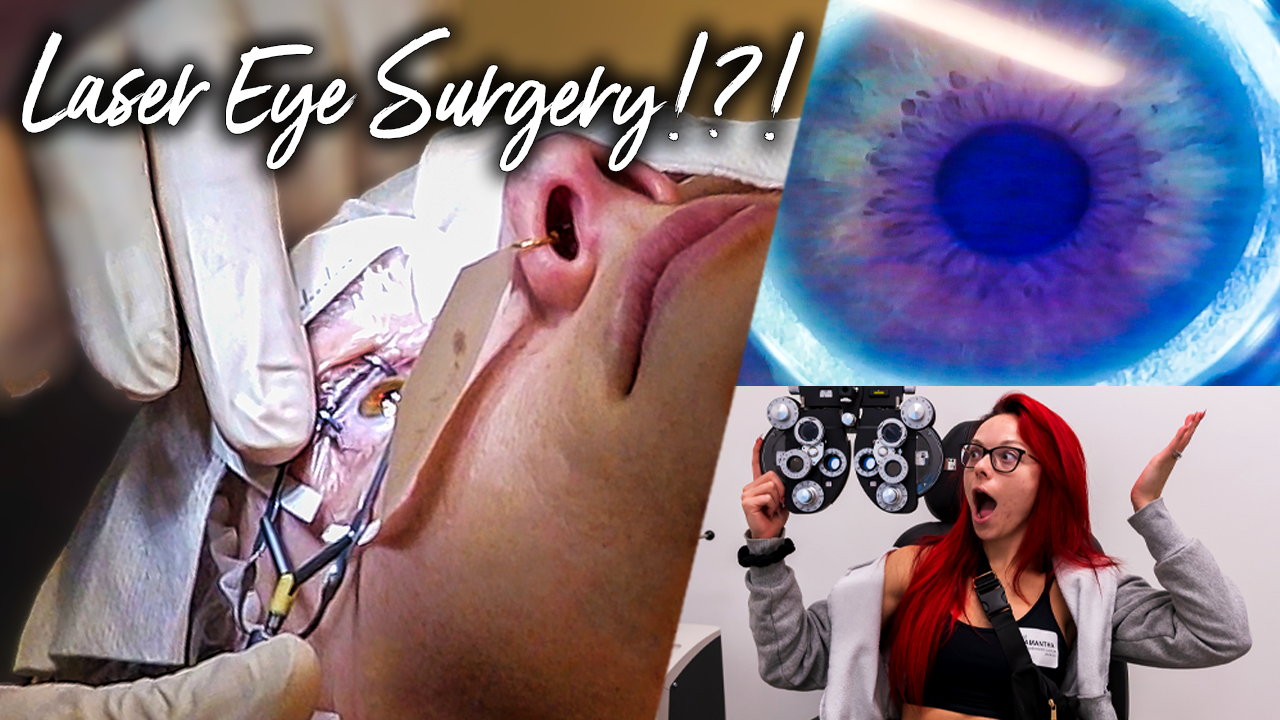 Lasik Eye Surgery Sammy Jo